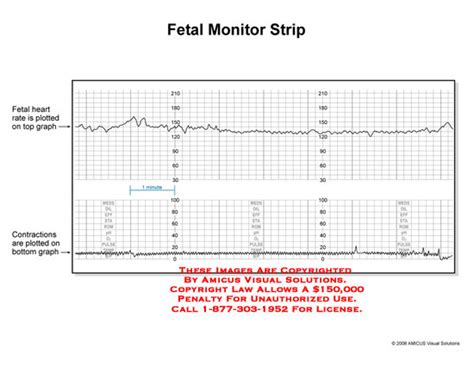 free practice fetal monitoring strips.